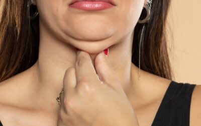 Double chin reduction with non-surgical Kybella