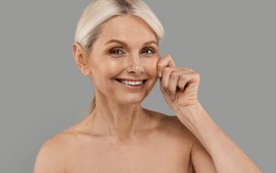 Stubborn cellulite and loose skin tightened with Velashape III